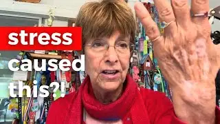 Autoimmune Condition: Symptoms & Healing (Viewer&rsquo;s Question) from Stress