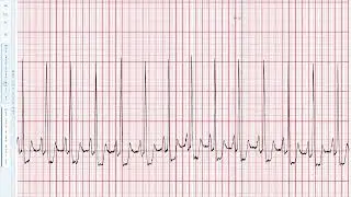 PULSE-FHIR: Plataforma Unificada de Leituras de Sinais ECG em FHIR