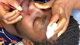ASMR Detailed face picking ~so relaxing 😴