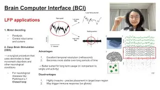 Local Field Potentials (LFPs) for BCIs