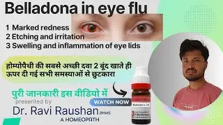 BELLADONNA in Eye Flu आंख आना या आंखों में सूजन और लालपन हो जाने की सबसे बेहतरीन होम्योपैथिक दवा