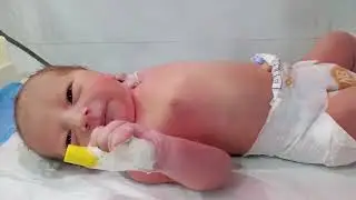 Infant of a Diabetic Mother (IDM)