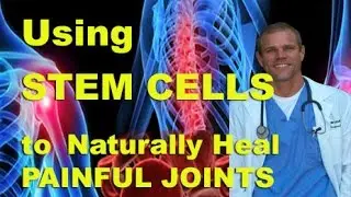 Adipose Derived Stem Cells or a Fat Graft for healing arthritis and joints with out surgery.