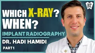 کدام رادیوگرافی ایمپلنت را درهرمرحله درمان باید انتخاب کرد؟|Right X-Ray, Right Implant(Episode_01)
