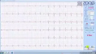 Cardioshield PC ECG Best Practice Integration
