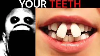 Mr Incredible Becoming Uncanny meme (Your teeth) | 50+ phases