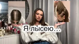 Как я узнала , что лысею !? Женская алопеция .