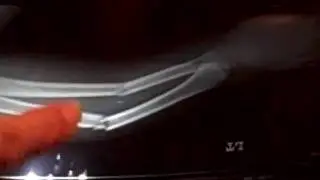 Mason's Second Elbow...Ouch!