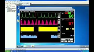 Patient Monitor Simulator for Windows   First Look
