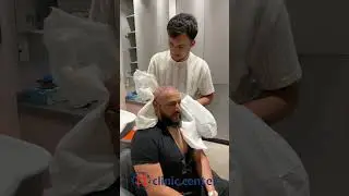 Hair Transplant in Turkey with Clinic Center  #cliniccenter