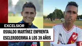 Irreconocible Osvaldo Mart&iacute;nez por esclerodermia