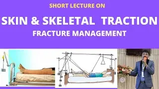 SKIN & SKELETAL TRACTION IN FRACTURE MANAGEMENT