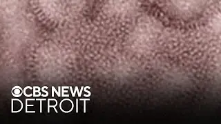 CDC classifies flu season as 