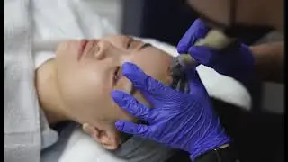 sylfirm-x-body - Treatment Showcase