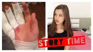 Comment je me suis coupé les doigts ! STORY TIME
