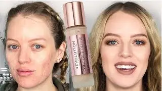 MAKEUP REVOLUTION Conceal & Define Full Coverage FOUNDATION REVIEW for Acne Prone Skin