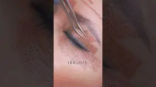 Special patern for eyelids lifting#phiion #plasmapen #plasmafibroblast #phiacademy #beauty #ubrow