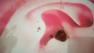 ASMR Ear cleansing - MASSIVE EAR WAX REMOVAL RESTORES HEARING AFTER 90 YEARS#######2