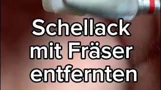 Schellack Modelage mit Fr&auml;ser entfernen