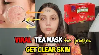 We Tried Chef Farah's Viral Acne Mask