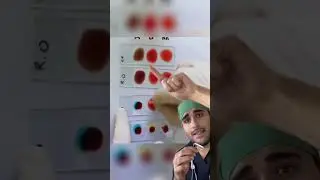 Doctor explains: How to know your blood type?!🤯🤯