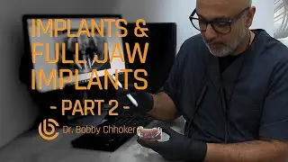 The Full Jaw On Four Process - In The Chair with Dr. Bobby Chhoker