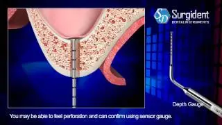 Aqua Toca Sinus Lift with Water Kit