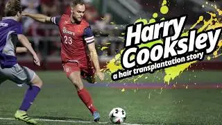 HARRY  COOKSLEY   |      HAIR TRANSPLANTATION TURKEY  |   ESTEPERA HAIR CLINIC