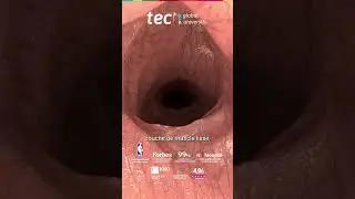 Anatomie vulvaire en gyn&eacute;cologie esth&eacute;tique et fonctionnelle ❘ TECH Global University