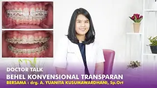 Jenis Behel - Behel Konvensional Transparan - Behel Gigi Bening yang Murah
