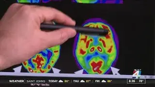 Does the age you develop diabetes determine your risk for dementia?
