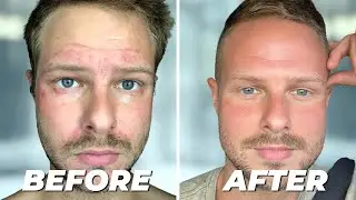 This Non-Toxic Skincare Routine Changed My Life (Honest Alitura Naturals Review)