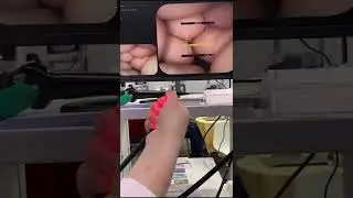 CMOS camera gastroscope and colonoscope demonstration-part 2