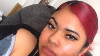 Dying My Hair Red With A Blue Indigo Skunk Stripe