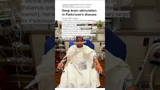 Deep brain stimulation in Parkinson&rsquo;s disease