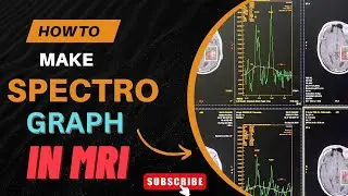 MRI Spectroscopy Graph Step by Step | How to Make & Interpret MRS Graph | Radiology Master&rdquo;