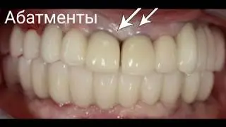 Почему десна синеет? Разбираем все случаи изменения цвета десен!