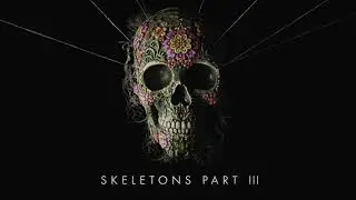 MISSIO – Losing My Mind – Stripped (From Skeletons: Part 3)
