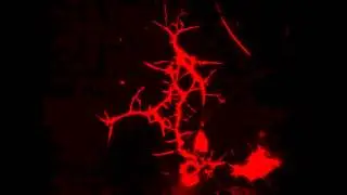 Neuroblasts -- axon growth + glia