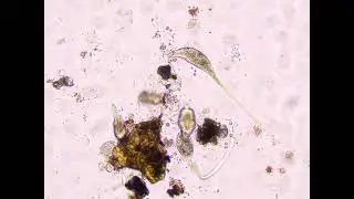 Aggressive Microscopic Hunters Catch Food