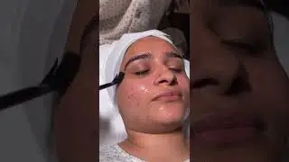 Skin treatment #skintreatment #aesthetician #skinexpert #skincareexperts #skinspecialist #beautician