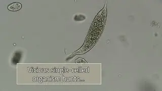 We Are Lucky These Are Microscopic...