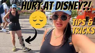 Hurt At Disney World | How To Handle Theme Park Injuries?!