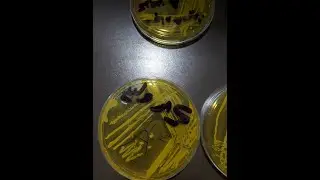 Staphylococcus aureus on mannitol salt agar