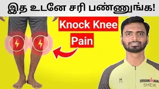 5 Science Proven Home Exercises For Knock Knee&nbsp;Pain&nbsp;(Tamil)