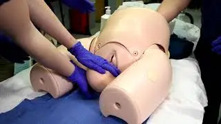 Shoulder Dystocia