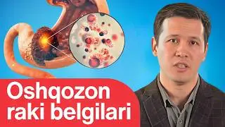 ОШҚОЗОН САРАТОНИ қандай касаллик, сабаблари, белгилари ва даволаш