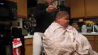 Dandruff