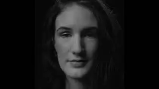 Ella&rsquo;s Skin Cancer Story | Protect Your Skin | Facebook