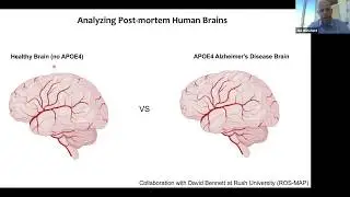 Faculty Forum Online: Lowering a Barrier to Understanding Alzheimer&rsquo;s